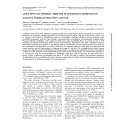 Long-term periodontal response to orthodontic treatment of palatally impacted maxillary canines