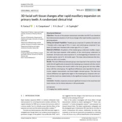 Fastuca R. et al. - OCR 2018 - 3D facial soft tissue changes after  RME on primary theeth a RCT