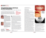 Caprioglio C. et al. - Dentista Moderno - 02-2020 - I Traumi in Dentizione Decidua