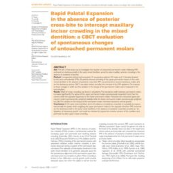 Rapid Palatal Expansion in the absence of posterior cross-bite to intercept maxillary incisor crowding in the mixed dentition: a CBCT evaluation of spontaneous changes of untouched permanent molars - 2017