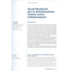 Quad Pendulum per la distalizzazione molare senza collaborazione